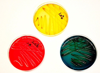 Differential media  is used for the isolation and differentiation of enteric pathogens. Pictured above is a positive Salmonella culture on Salmonella/Shigella agar (SS), Hektoen agar (HE) and  Xylose Lysine deoxycholate agar (XLD).