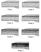 Pigmentation staging chart