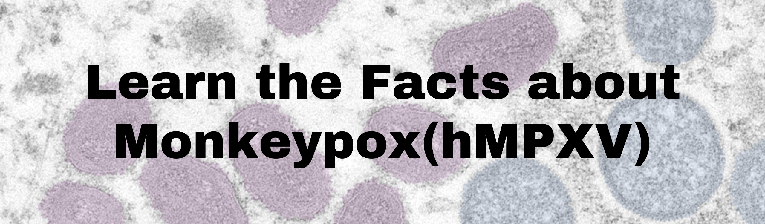 Monkeypox (hMPXV)