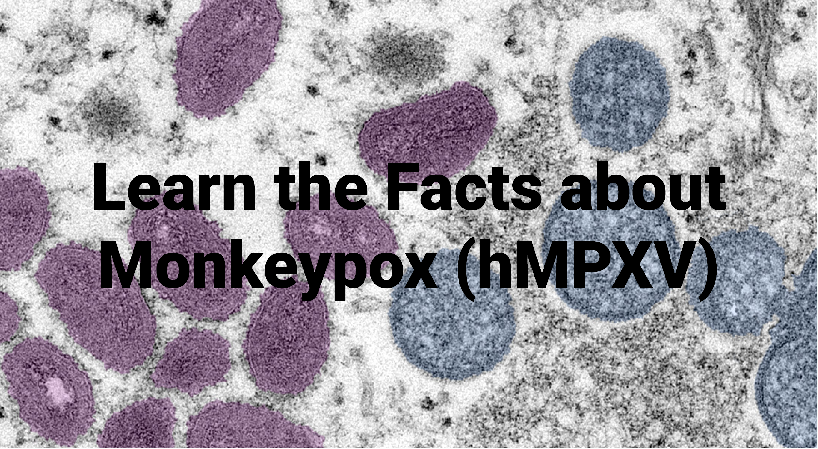 Monkeypox Image