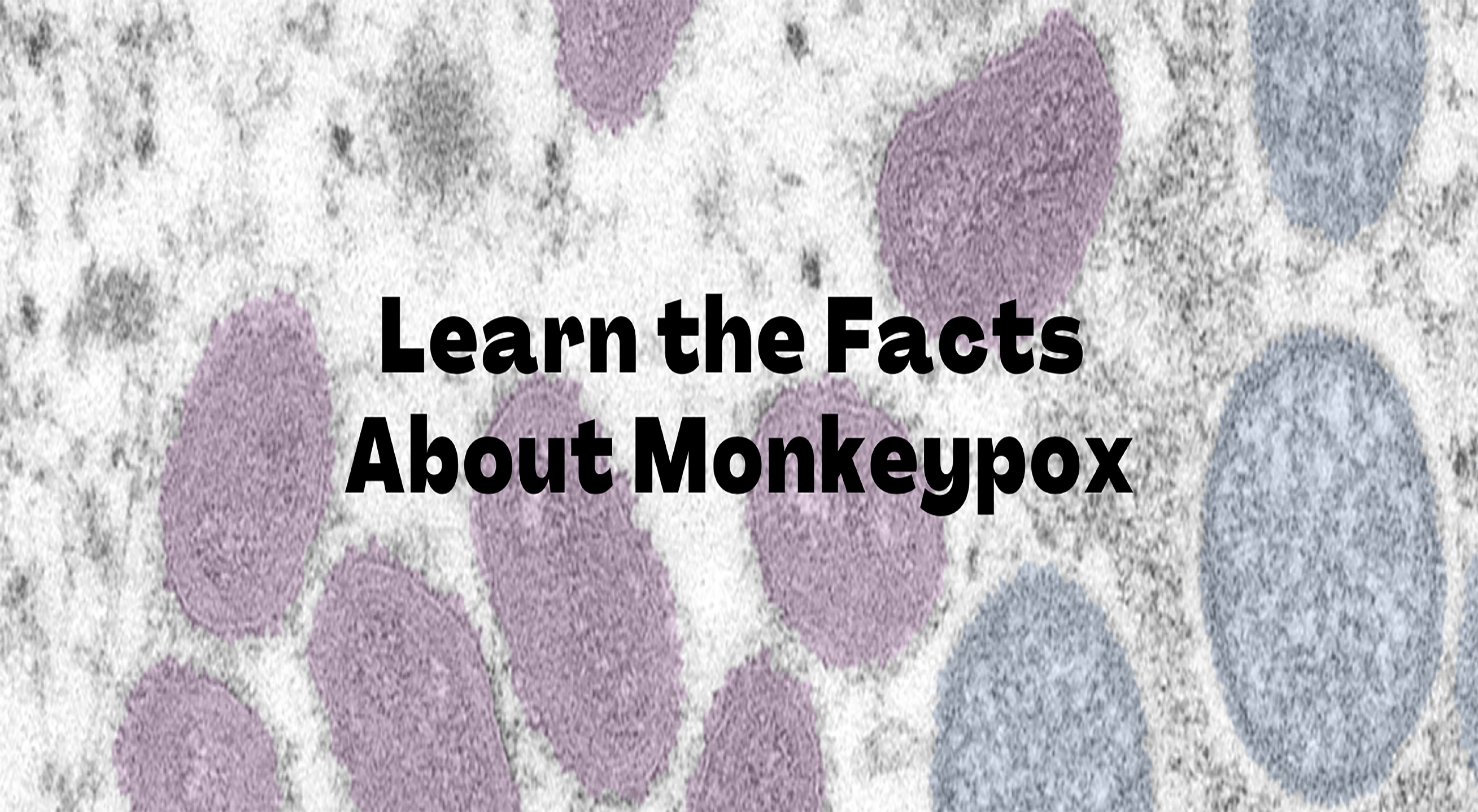 Monkeypox Image
