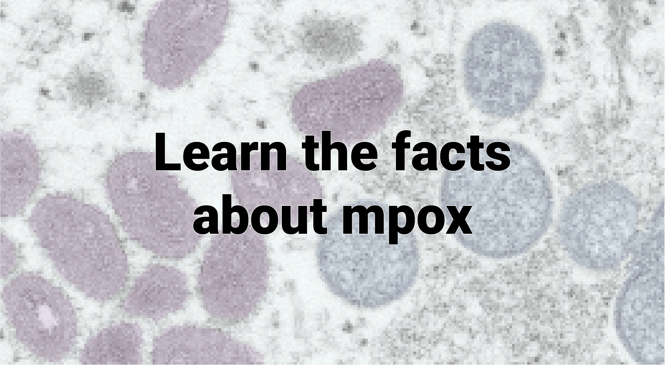 mpox