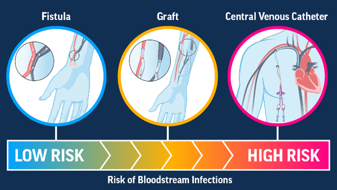 Centers for Disease Control and Prevention's Dialysis Infection Prevention Tools.