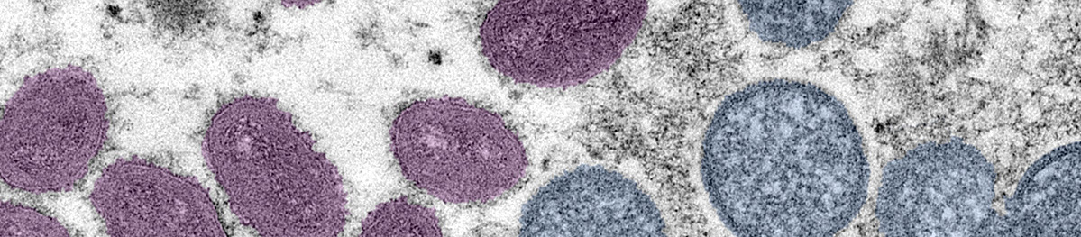 Mpox cells (close up image)