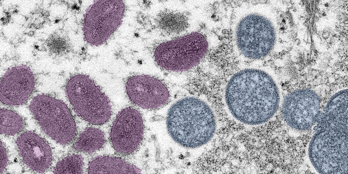 Close up image of the mpox virus