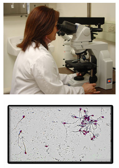 Confirmatory Test for Semen